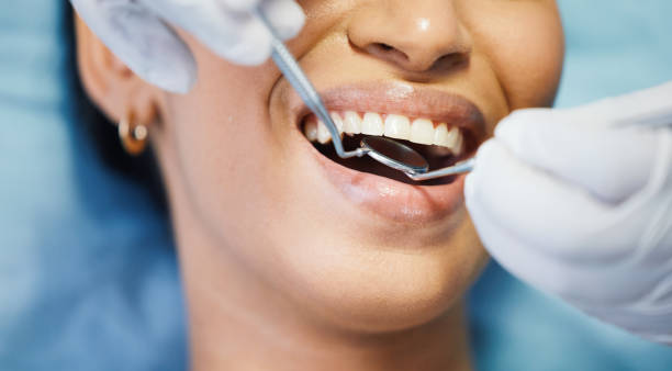 Best Emergency Dental Care for Broken or Chipped Teeth in Huntington, UT